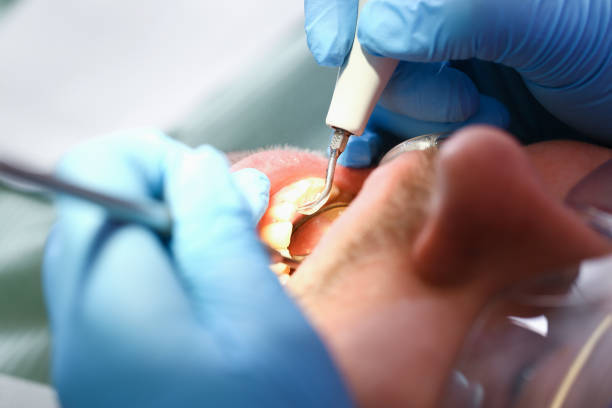 Emergency Dentist Open Today in NE